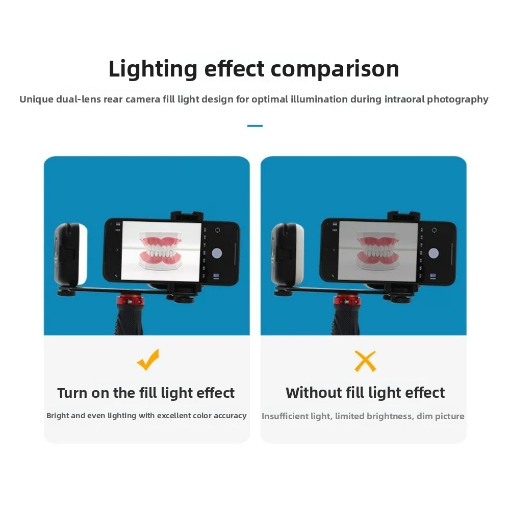 Dental Photography Light, Blue - Photography Lighting Kit review and price